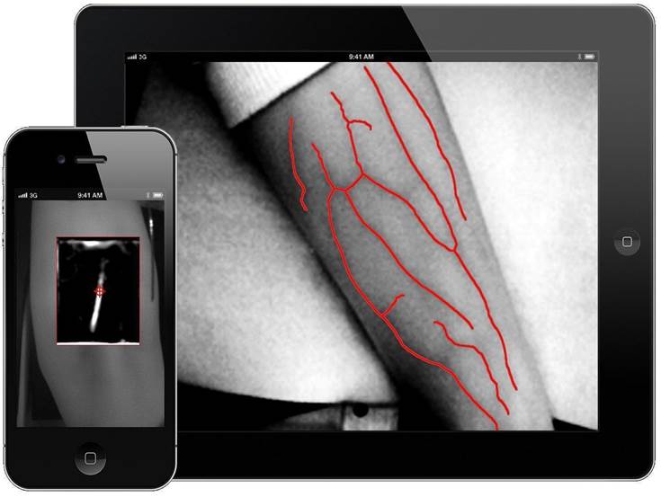 Mobie Vein Imaging App